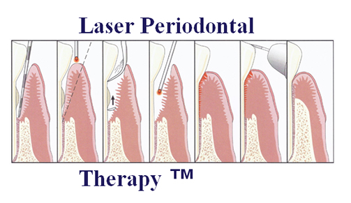 Advanced Periodontal Therapies, Periodontology